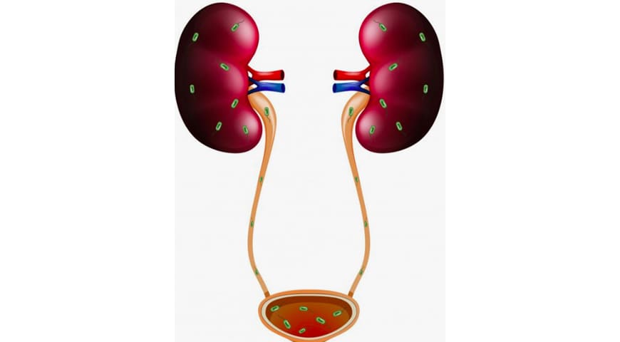 Infecciones de vías urinarias